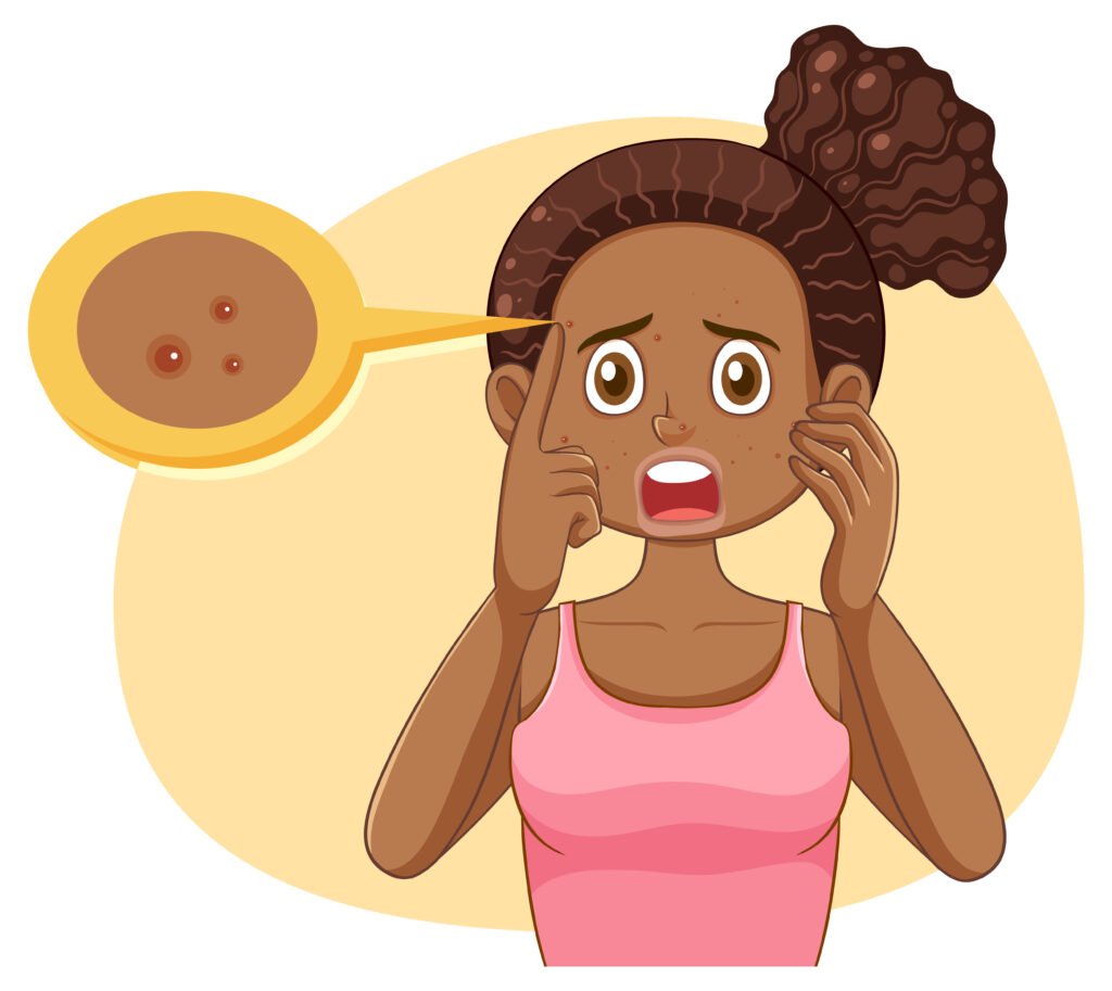 Comment enlever les boutons rapidement au Mali (Guide complet)